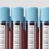 Direct-to-Consumer Blood Testing: Empowerment or Peril?